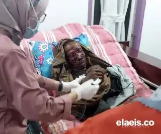 Petani di Inhu Diserang Beruang, Bagian Wajah Robek